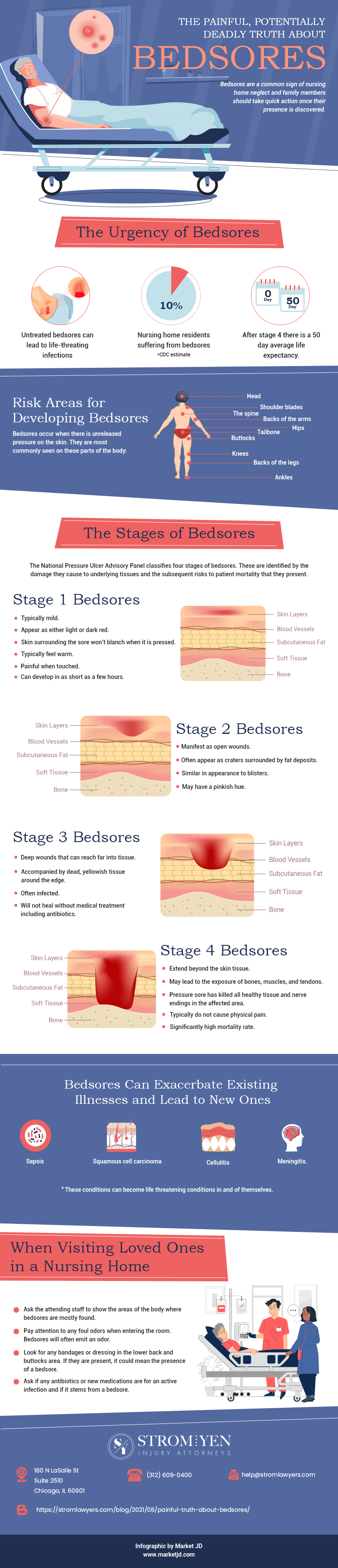 Stages of Bedsores