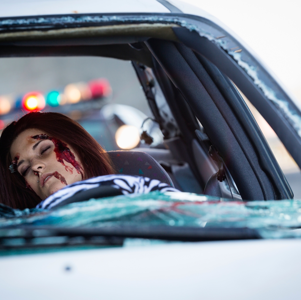 Woman suffering a head injury after a car accident
