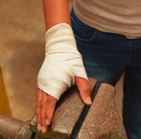 Injured hand at work